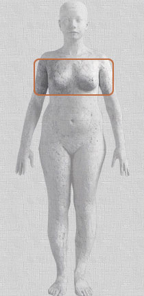Brustchirurgie